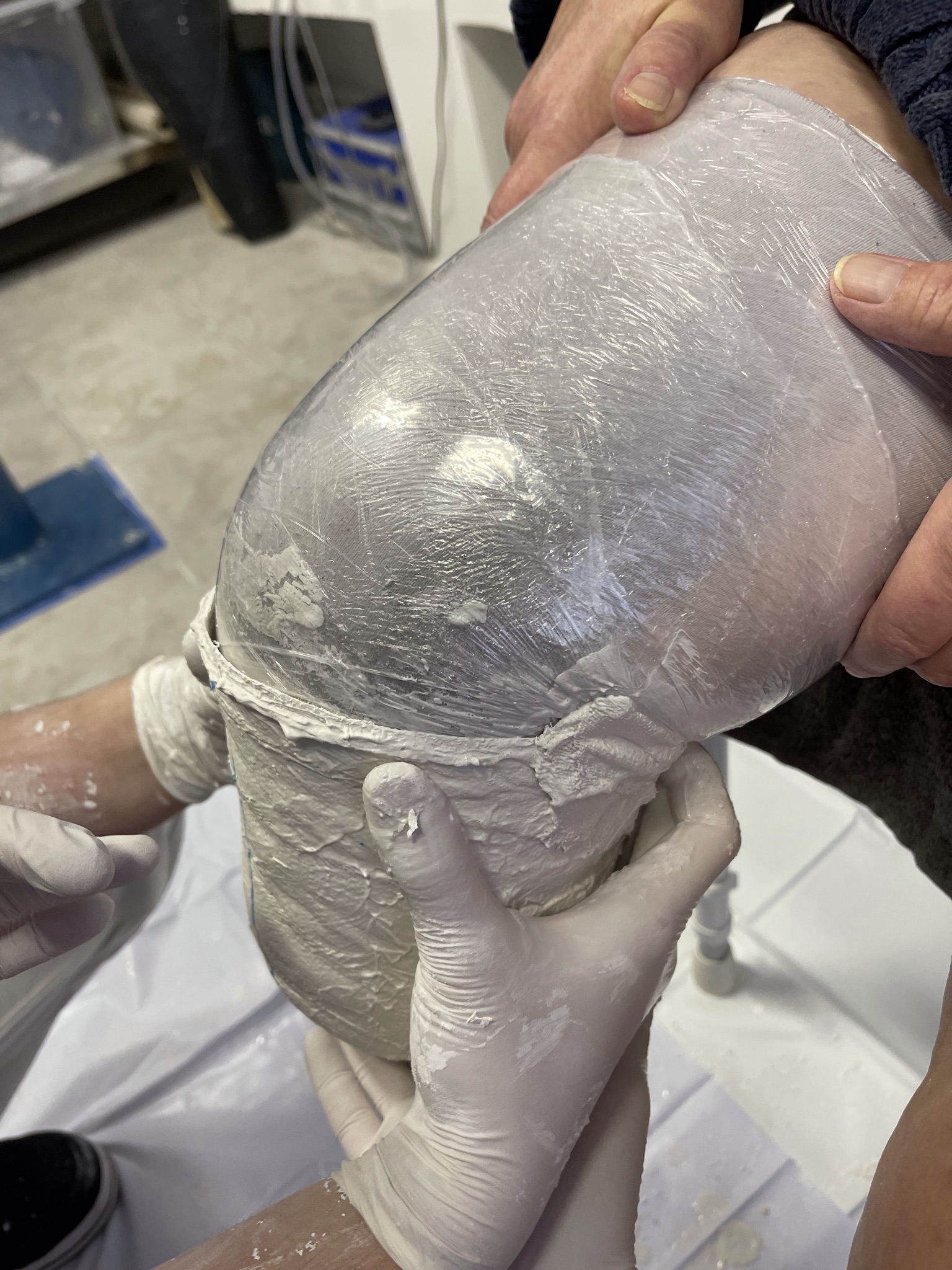 Anpassung eines Gipsabdruckes